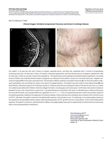 lushings compression test|cushing's syndrome mri.